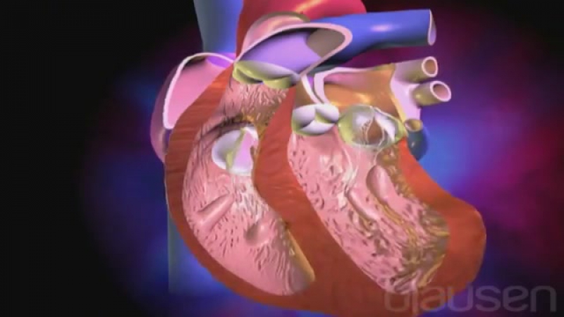 40 стеноз митрального клапана