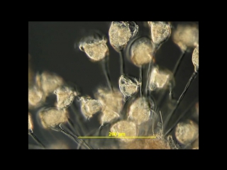 Carchesium a beautiful colonial ciliate actively feeding