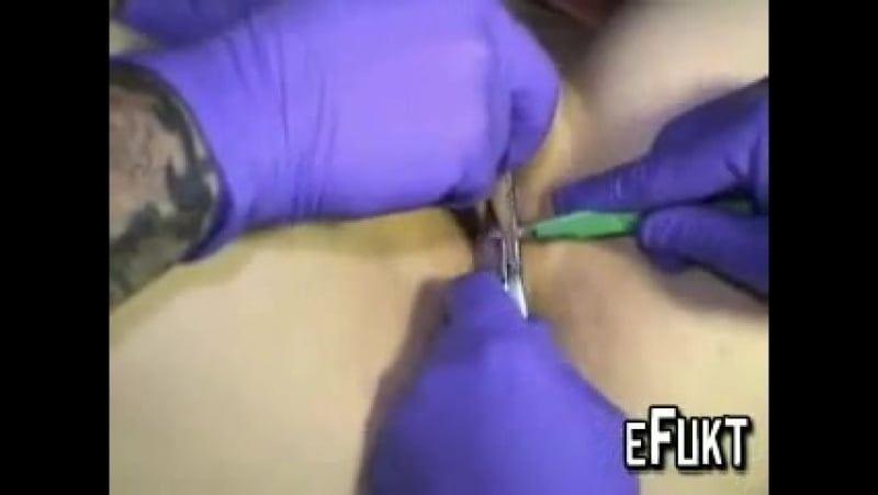 Genital Mutilation Porn - Female circumcision watch online