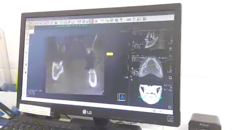 Компьютерная томограмма