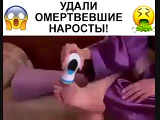 Красивые ножки без трещин, мозолей и натоптышей