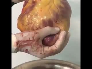 Так что имеют ввиду когда говорят человек с большим сердцем!