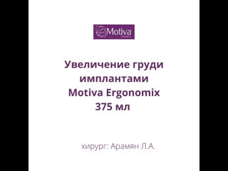 Увеличение груди имплантами motiva ergonomix, 375 мл