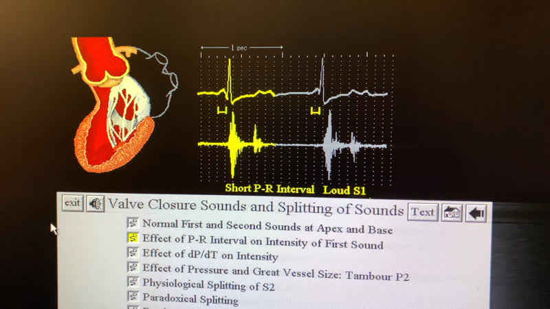 Молодые болезни шумы при впс
