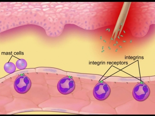 The inflammatory response [hd animation]