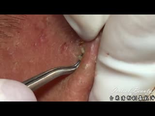 Выдавливания крупно