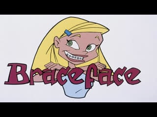 Braceface burrrrn it doooown 😂😂