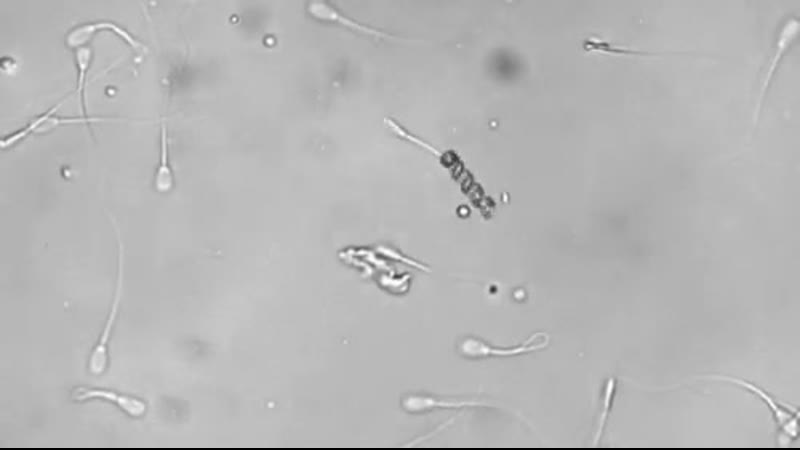 Нанобот производит искусственное оплодотворение яйцеклетки