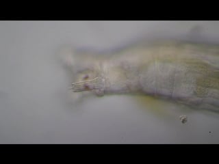 Rotaria citrina, pregnant with twins