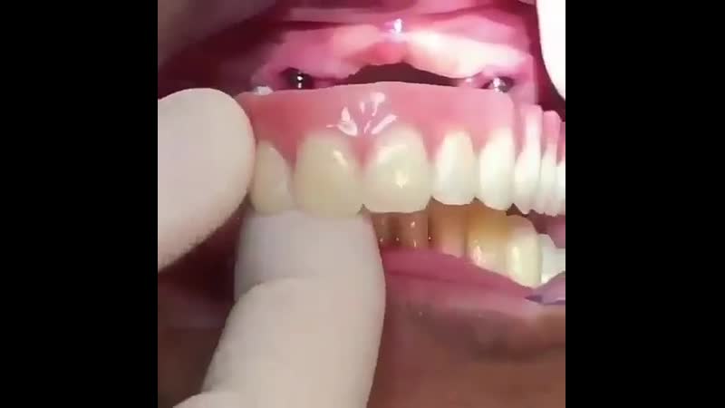 Стоматологи какова цена такого протезирования?