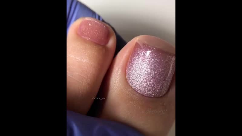 Кошачий глаз