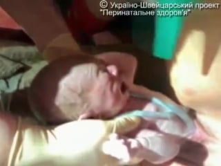 Роды