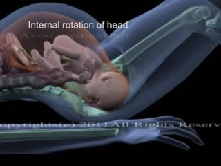 Childbirth animation movements of fetus during birth