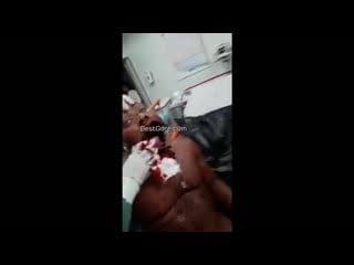 Разорвало рот!!