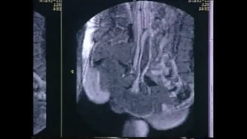 Уверен, вы никогда не видели секс через аппарат мрт