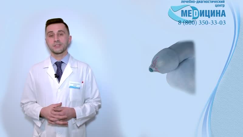 Фимоз обрезание