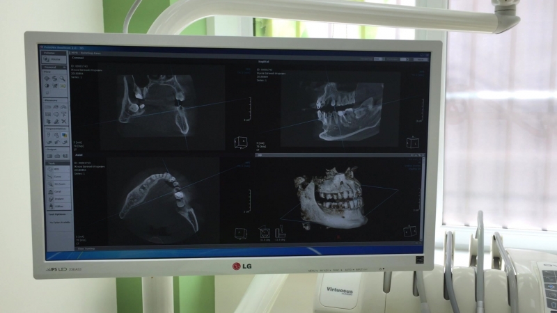 Компьютерная томограмма