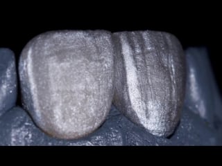 Denis rizzo zirpress esthétique