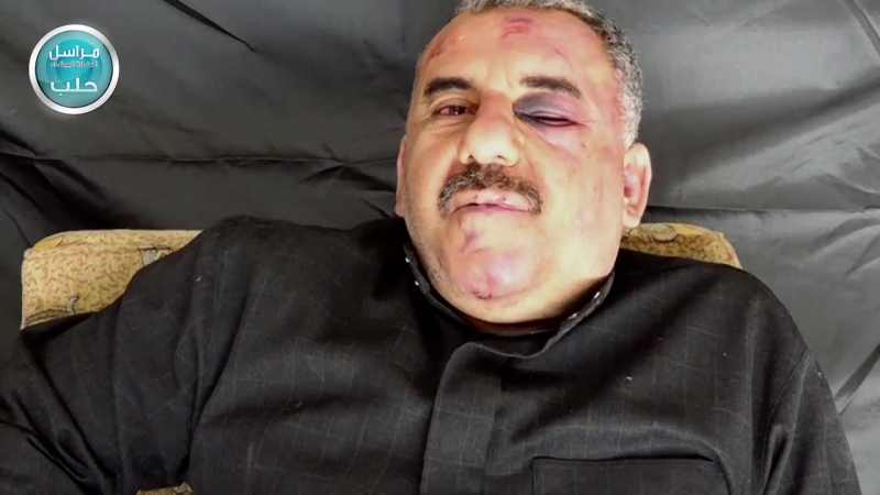 ✔ особое мнение боевики опубликовали новое видео избитого пилота су 22 ввс сирии