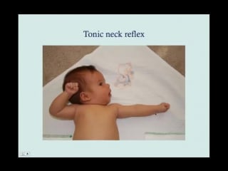 Nursery examination (part 2) crash! usmle step 2 and 3