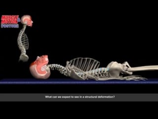 Observing posture patterns while lying on the back