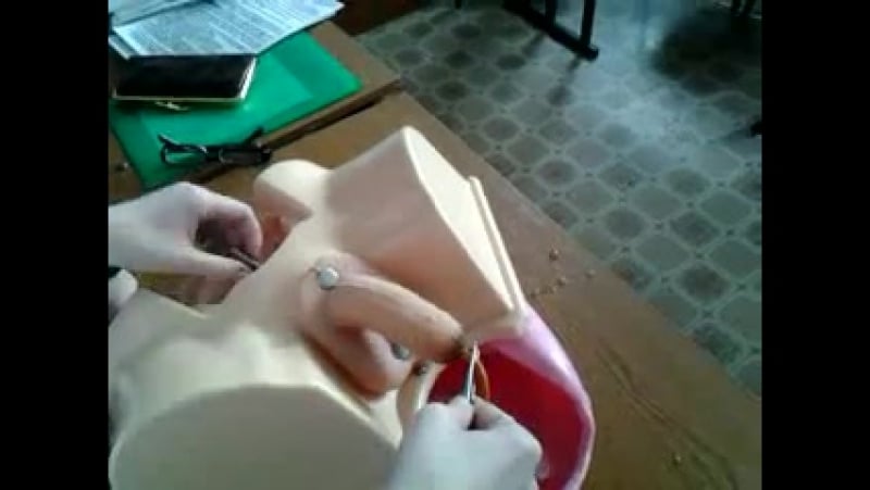 Катетеризация мочевого пузыря у мужчины