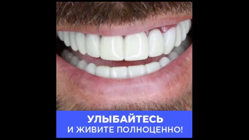 Голливудская улыбка за 3 секунды