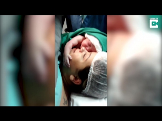 Emotional moment newborn clings to mothers face