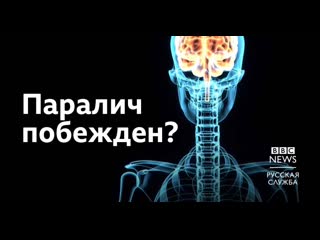 Ученые из австралии смогли вылечить паралич рук и кистей