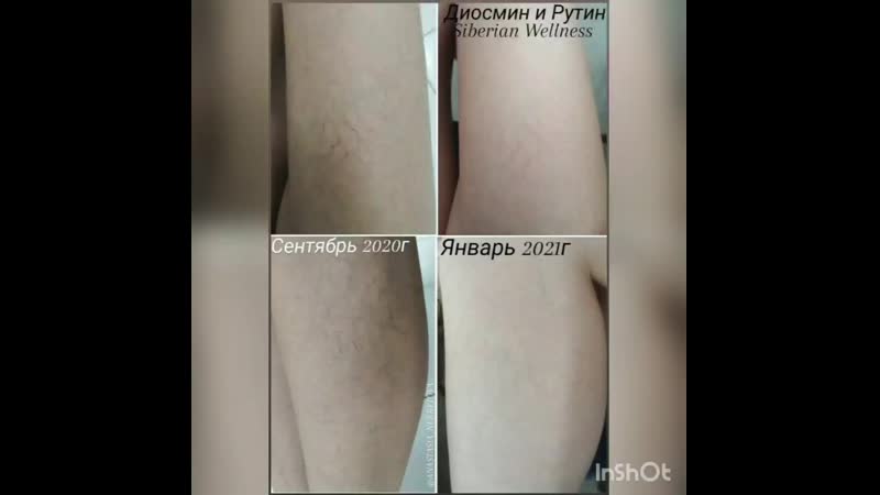 Wellness porn video – Видео от siberian wellness/сибирское здоровье#агрыз
