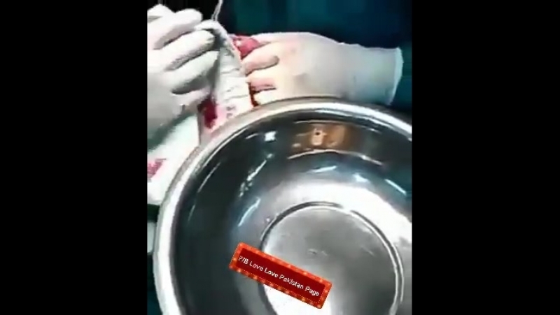 Сколько глистов в кишечнике