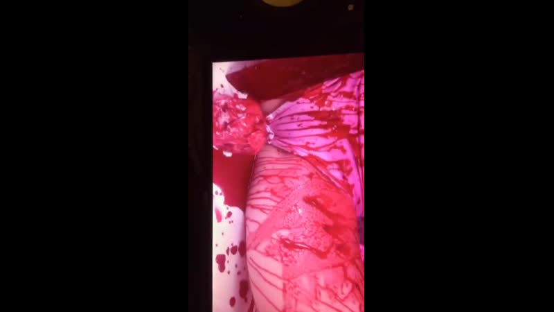 Phalic crucifixion x dollrot x bushpig scat butcher – snake queen &amp; 2 bonus tracks (snippet)