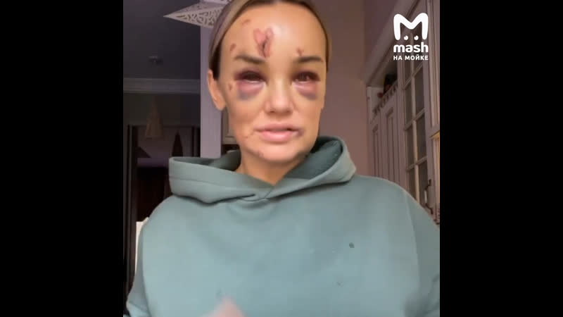 Блогера анну леонову жестоко избили