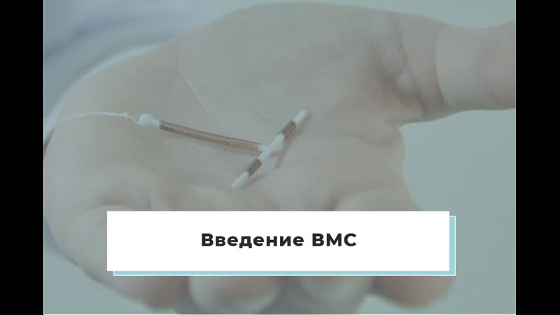 Введение внутриматочной спирали