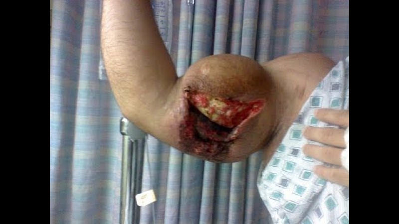 Люди мутанты или качки монстры бодибилдинг и синтол!