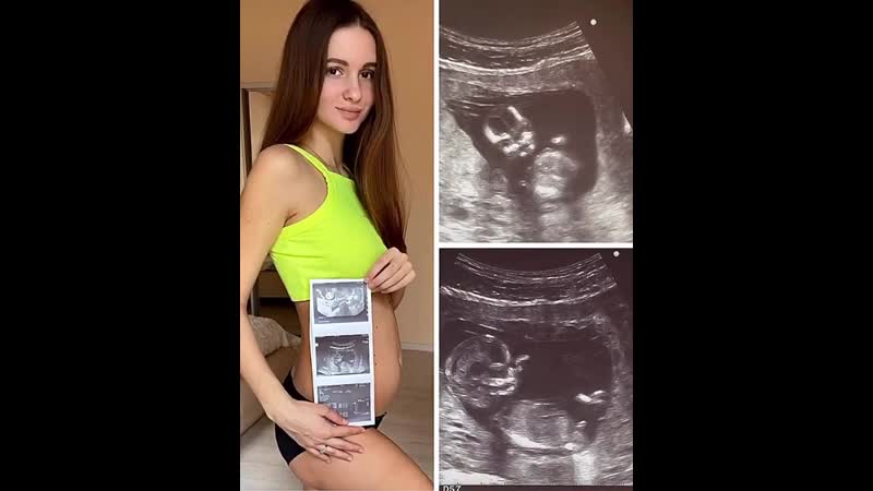 Беременная жена чуева показала снимки с узи