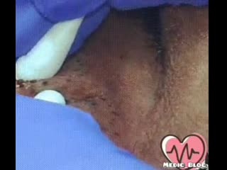 Черные точки извращенцам на усладу глаз