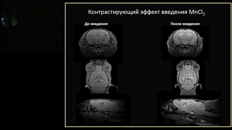 Андрей акулов «магнитно резонансная томография׃ притягательный метод»