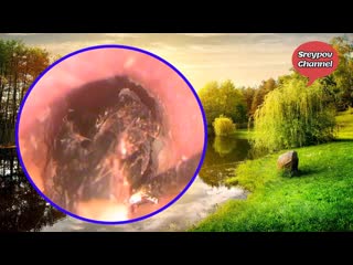 Вытаскивание мягкой серной пробки