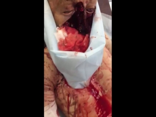 Чудом выжил в дтп