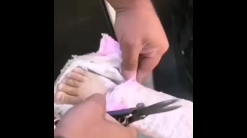 Гипс снимают сами