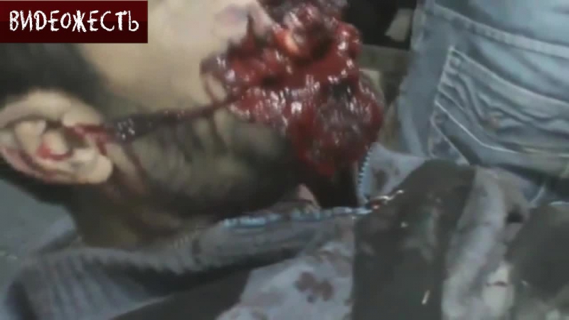 Кариес © видеожесть