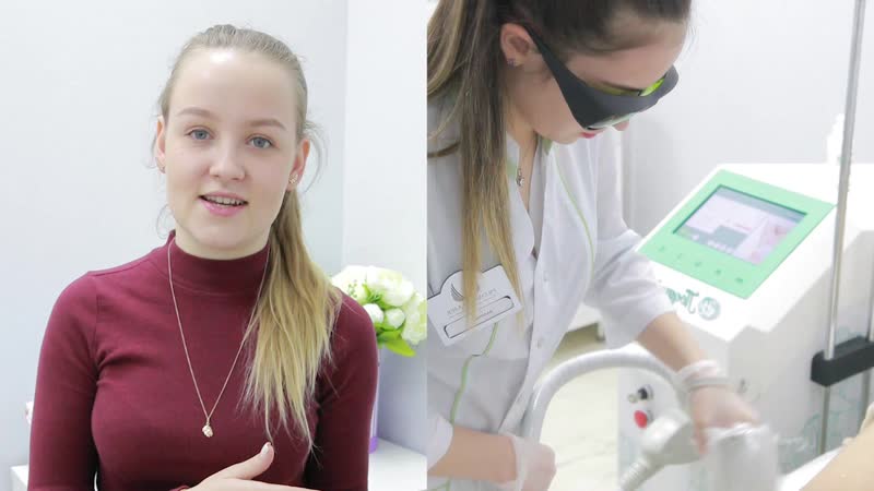 Отзыв о лазерной эпиляции