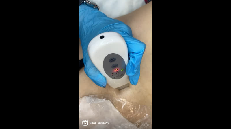 Ультразвуковая чистка бикини! 🔥