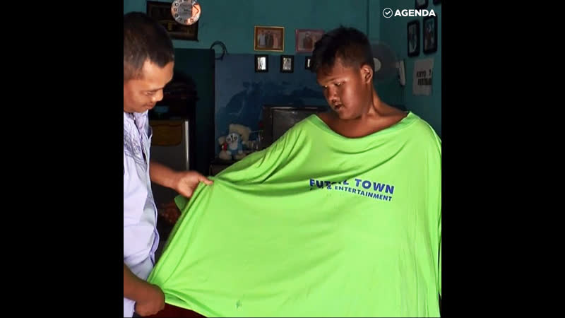 Самый полный ребенок в мире похудел