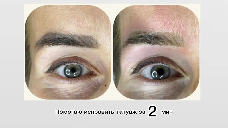 Результат исправления некачественного татуажа