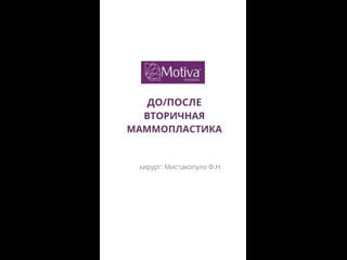 Вторичная маммопластика