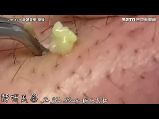 Выдавливания очень крупно