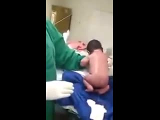 Новорожденный малыш пытается ходить сразу после родов