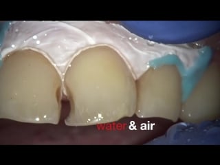 Teflon dr denis krutikov